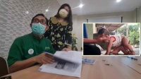 Tim Dokter Kembar Siam RSU dr Soetomo Siap Tangani Bayi Kembar Siam Berkaki Enam