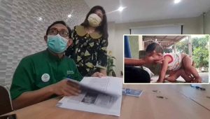 Tim Dokter Kembar Siam RSU dr Soetomo Siap Tangani Bayi Kembar Siam Berkaki Enam
