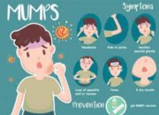 Virus Gondongan Serang Lumajang, Ini Upaya Dinkes P2KB