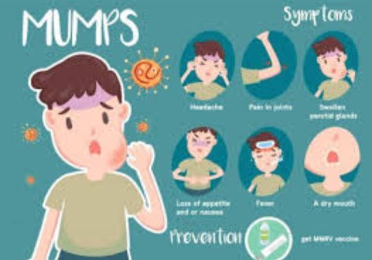 Virus Gondongan Serang Lumajang, Ini Upaya Dinkes P2KB