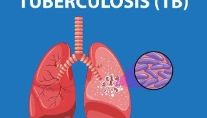 Uji Klinis Vaksin TBC M72: Upaya Selamatkan Bangsa, Bukan Ancaman